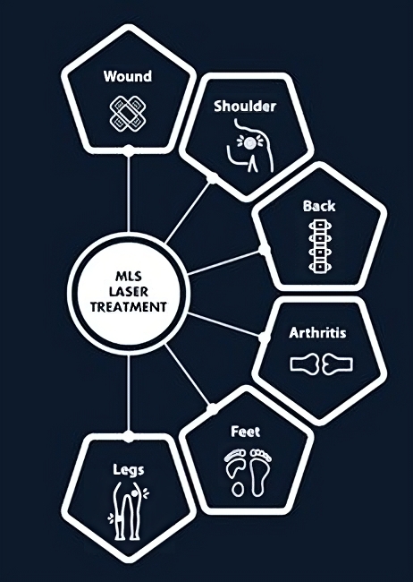 Webinar: Using MiS Laser for Effective Neuropathic Pain Management